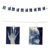 Girlang med LED-belysning Röntgen