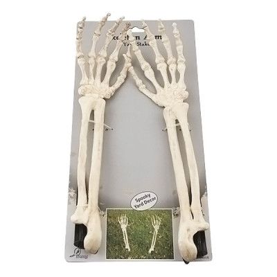 Skelettarmar ur Marken