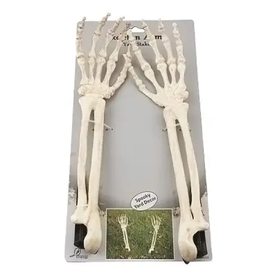 Skelettarmar ur Marken